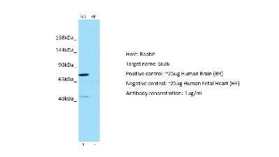 Western Blot: SEZ6/BSRP-C Antibody [NBP2-88248]