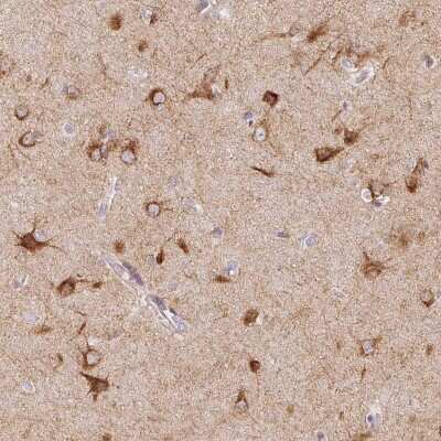 Immunohistochemistry: SEZ6L2/BSRP-A Antibody [NBP2-38051]
