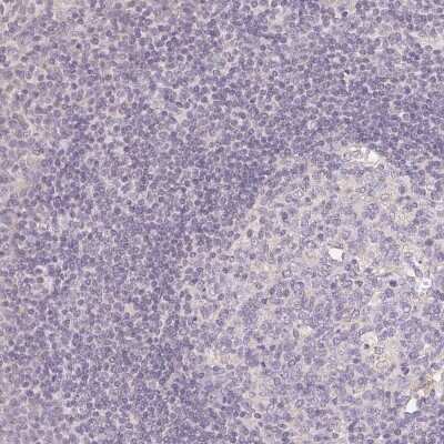 Immunohistochemistry-Paraffin: SEZ6L2/BSRP-A Antibody [NBP2-38051]