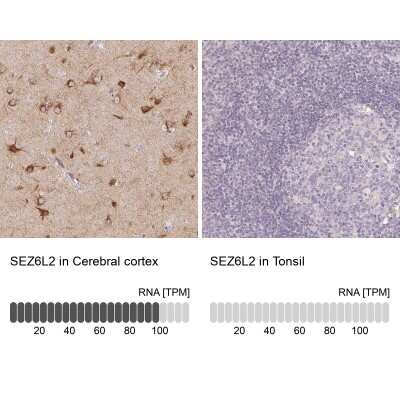 Immunohistochemistry-Paraffin: SEZ6L2/BSRP-A Antibody [NBP2-38051]
