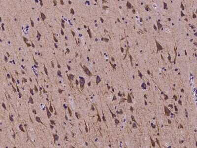 Immunohistochemistry-Paraffin: SEZ6L2/BSRP-A Antibody [NBP2-97264]