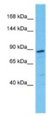 Western Blot: SEZ6L2/BSRP-A Antibody [NBP3-09952]