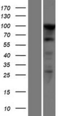 Western Blot: SEZ6L2/BSRP-A Overexpression Lysate [NBP2-04600]
