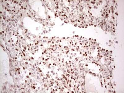 Immunohistochemistry: SF-1/NR5A1/Steroidogenic Factor 1 Antibody (OTI1B4) [NBP2-46247]