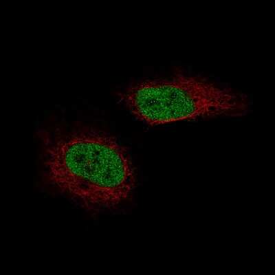 Immunocytochemistry/ Immunofluorescence: SF-1/NR5A1/Steroidogenic Factor 1 Antibody (CL9101) [NBP2-88921]