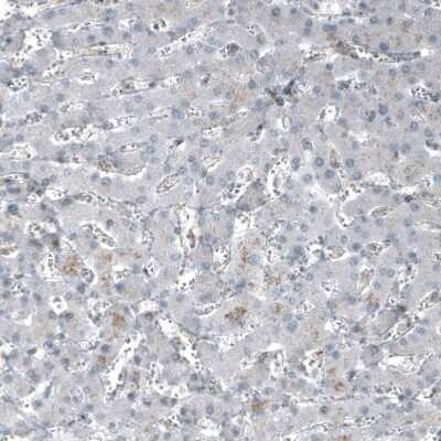Immunohistochemistry-Paraffin: SF-1/NR5A1/Steroidogenic Factor 1 Antibody (CL9101) [NBP2-88921]