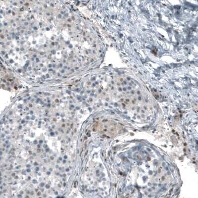 Immunohistochemistry-Paraffin: SF-1/NR5A1/Steroidogenic Factor 1 Antibody (CL9101) [NBP2-88921]