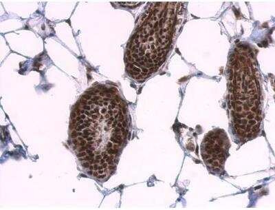 Immunohistochemistry-Paraffin: SF2 Antibody [NBP2-20324]