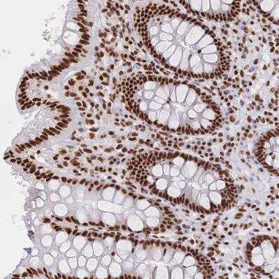 Immunohistochemistry-Paraffin: SF2 Antibody [NBP2-38912]