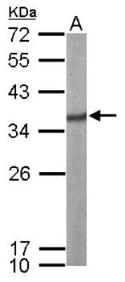 Western Blot: SF2 Antibody [NBP2-20324]