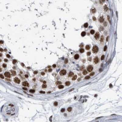 Immunohistochemistry-Paraffin: SF3A1 Antibody [NBP1-87215]