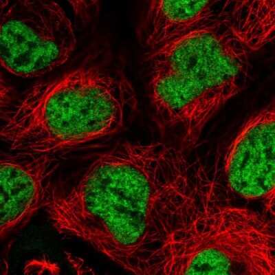 Immunocytochemistry/ Immunofluorescence: SF3A2 Antibody [NBP2-47281]