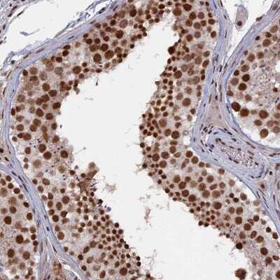 Immunohistochemistry: SF3A2 Antibody [NBP2-48775]