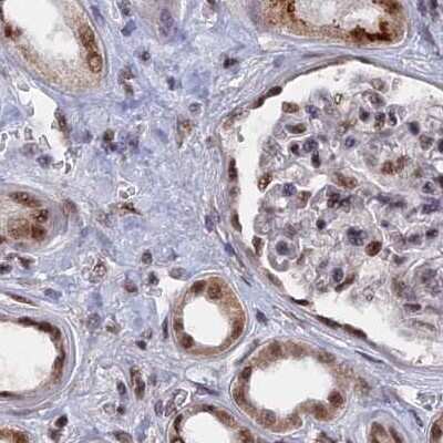 Immunohistochemistry-Paraffin: SF3A2 Antibody [NBP2-48775]