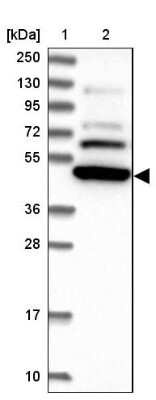 Western Blot: SF3A2 Antibody [NBP2-48775]