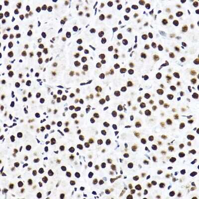 Immunohistochemistry-Paraffin: SF3A3 Antibody - Azide and BSA Free [NBP2-94076]