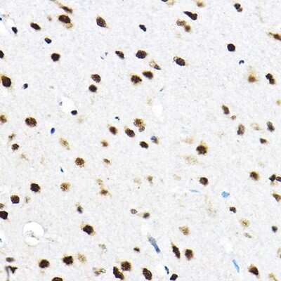 Immunohistochemistry-Paraffin: SF3A3 Antibody - Azide and BSA Free [NBP2-94076]
