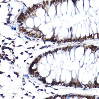 Immunohistochemistry-Paraffin: SF3A3 Antibody - Azide and BSA Free [NBP2-94076]