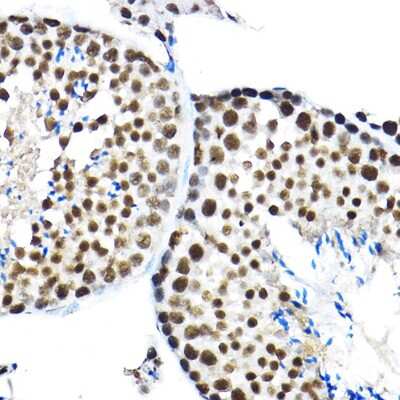Immunohistochemistry-Paraffin: SF3A3 Antibody - Azide and BSA Free [NBP2-94076]