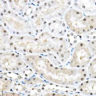 Immunohistochemistry-Paraffin: SF3A3 Antibody - Azide and BSA Free [NBP2-94076]