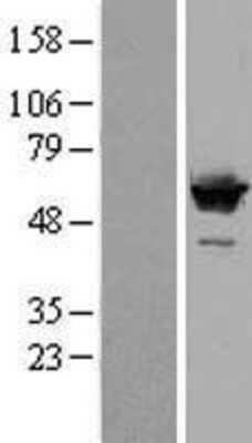 Western Blot: SF3A3 Overexpression Lysate [NBL1-15875]