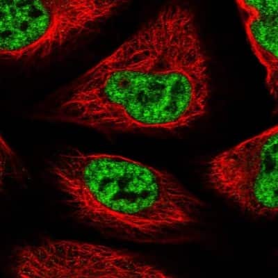 Immunocytochemistry/ Immunofluorescence: SF3B14 Antibody [NBP1-87431]