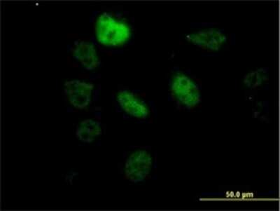 Immunocytochemistry/ Immunofluorescence: SF3B2 Antibody (5D2) [H00010992-M01]