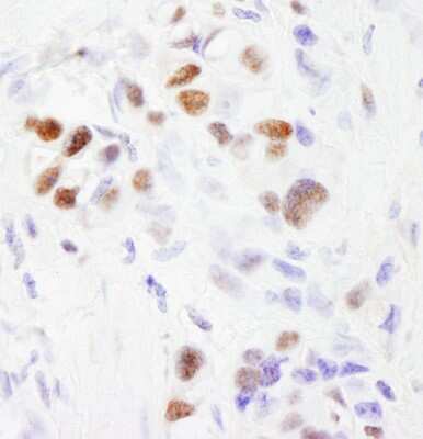Immunohistochemistry-Paraffin: SF3B2 Antibody [NB100-79848]