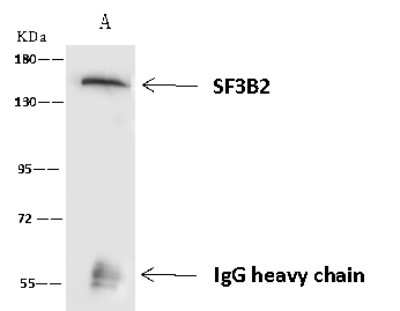 Immunoprecipitation: SF3B2 Antibody [NBP2-97657]