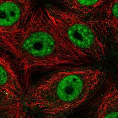 Immunocytochemistry/ Immunofluorescence: SF3B4 Antibody [NBP2-55882]