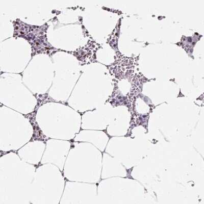 Immunohistochemistry-Paraffin: SF3B5 Antibody [NBP2-13301]