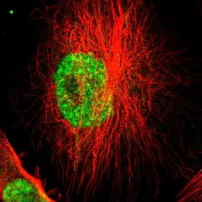 Immunocytochemistry/ Immunofluorescence: SF4 Antibody [NBP1-88000]