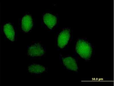 Immunocytochemistry/ Immunofluorescence: SFMBT1 Antibody [H00051460-B01P]
