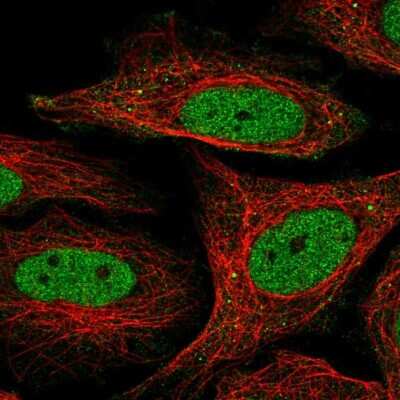 Immunocytochemistry/ Immunofluorescence: SFMBT1 Antibody [NBP2-56939]
