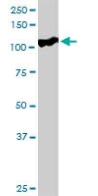 Western Blot: SFMBT1 Antibody [H00051460-D01P]
