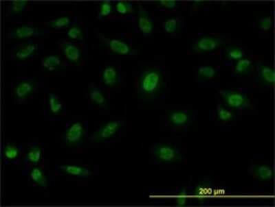 Immunocytochemistry/ Immunofluorescence: SFPQ Antibody (6D7) [H00006421-M02]