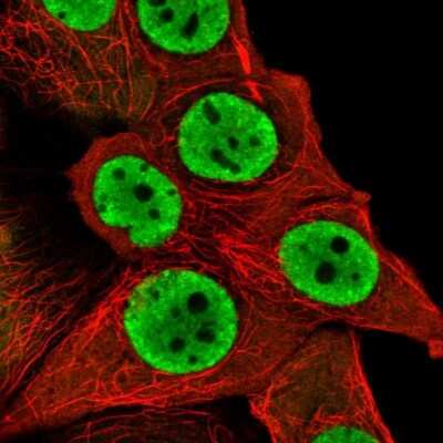 Immunocytochemistry/ Immunofluorescence: SFPQ Antibody [NBP2-48876]