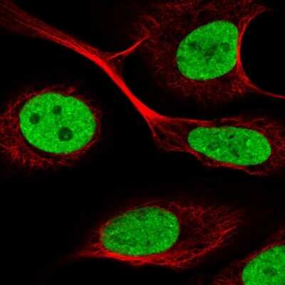 Immunocytochemistry/ Immunofluorescence: SFPQ Antibody [NBP2-49147]