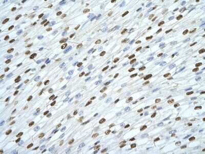 Immunohistochemistry: SFPQ Antibody [NBP1-57303]