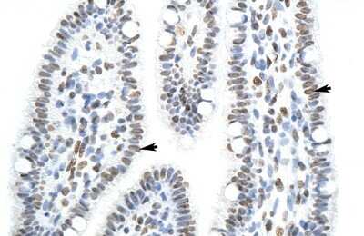 Immunohistochemistry-Paraffin: SFPQ Antibody [NBP1-57458]