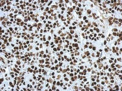 Immunohistochemistry-Paraffin: SFPQ Antibody [NBP2-20329]