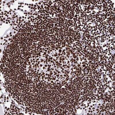 Immunohistochemistry-Paraffin: SFPQ Antibody [NBP2-48876]