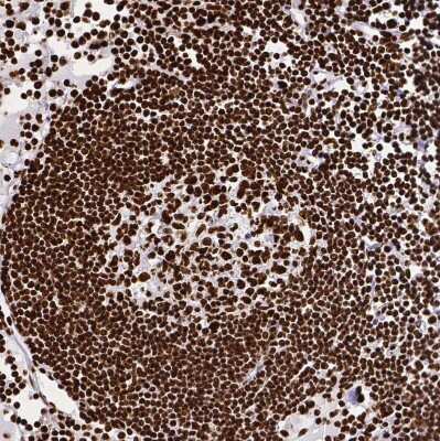Immunohistochemistry-Paraffin: SFPQ Antibody [NBP2-49147]