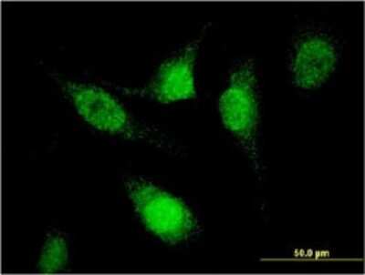 Immunocytochemistry/ Immunofluorescence: SFRS12 Antibody (1D11) [H00140890-M01]
