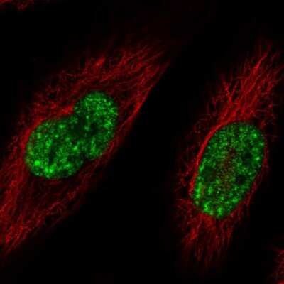 Immunocytochemistry/ Immunofluorescence: SFRS12 Antibody [NBP2-55143]