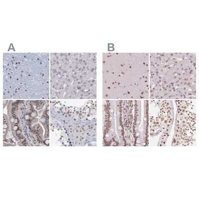 Immunohistochemistry-Paraffin: SFRS12 Antibody [NBP1-87993]