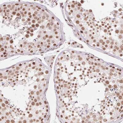 Immunohistochemistry-Paraffin: SFRS12 Antibody [NBP2-57236]