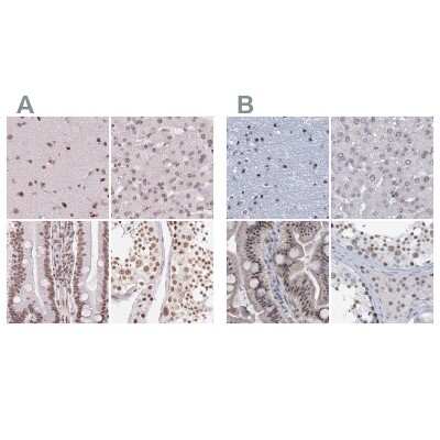 Immunohistochemistry-Paraffin: SFRS12 Antibody [NBP2-57236]