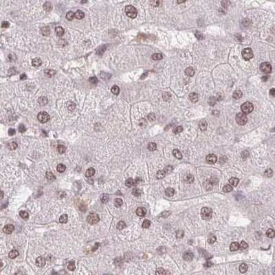 Immunohistochemistry-Paraffin: SFRS12 Antibody [NBP2-57236]