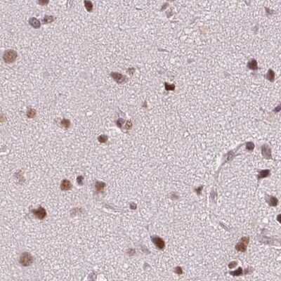 Immunohistochemistry-Paraffin: SFRS12 Antibody [NBP2-57236]